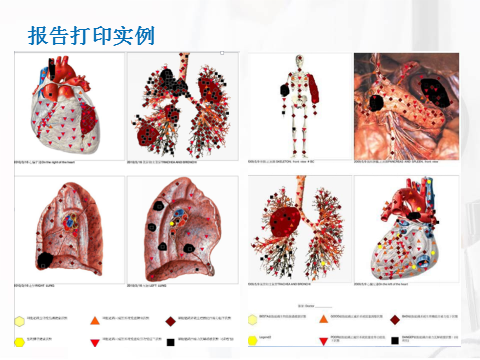 非线性分析健康管理系统